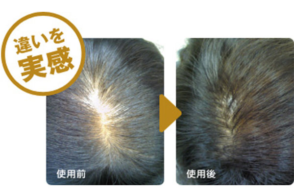 Volume Up Mist Suntreg